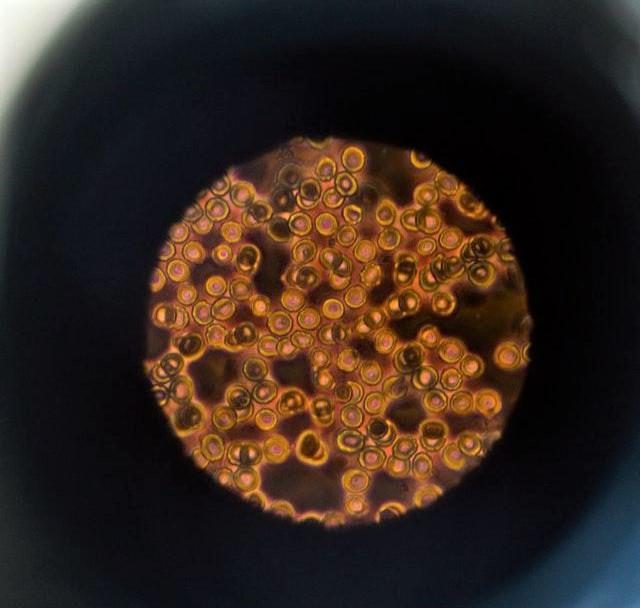 pod mikroskopskim steklom